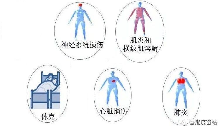 夏季不会有流感？病毒面前可容不得侥幸